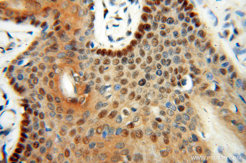 LTA4H Polyclonal antibody