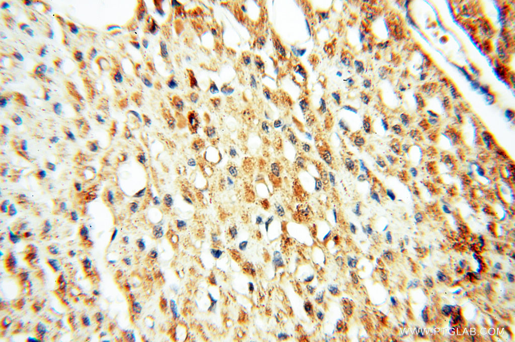 SFTPB Polyclonal antibody