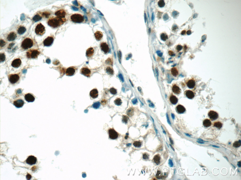 CTNNBL1 Polyclonal antibody