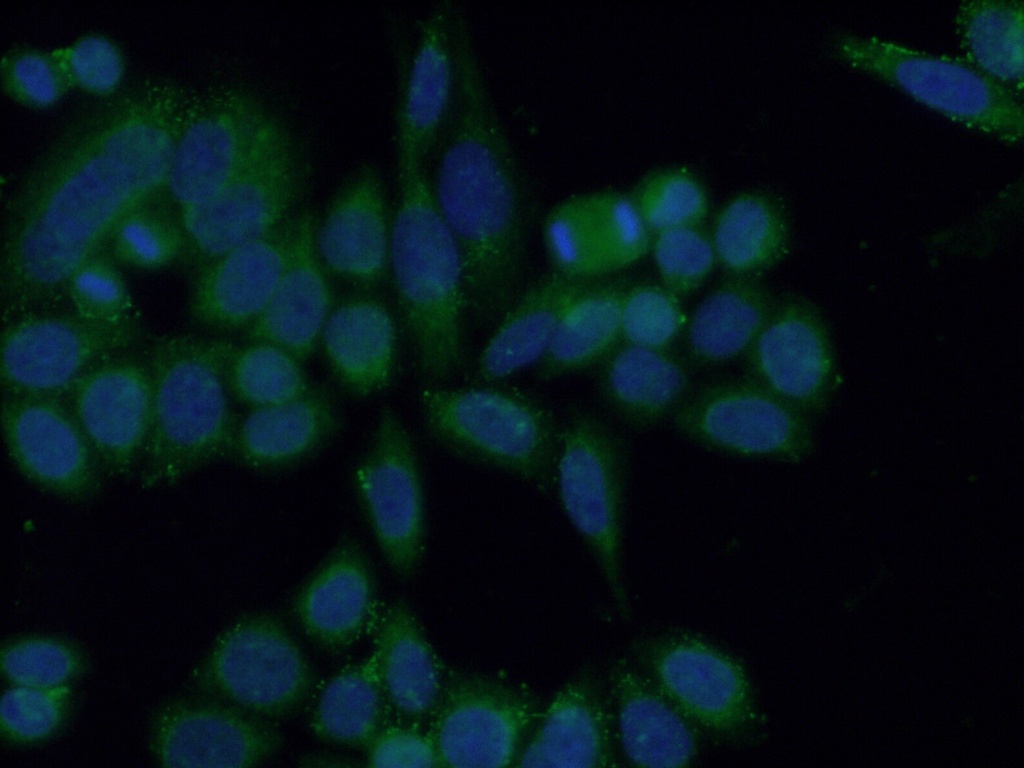 CA7 Polyclonal antibody