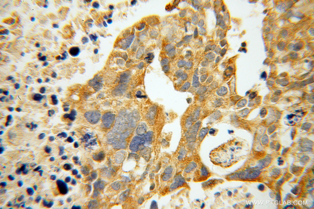 ATP11B Polyclonal antibody