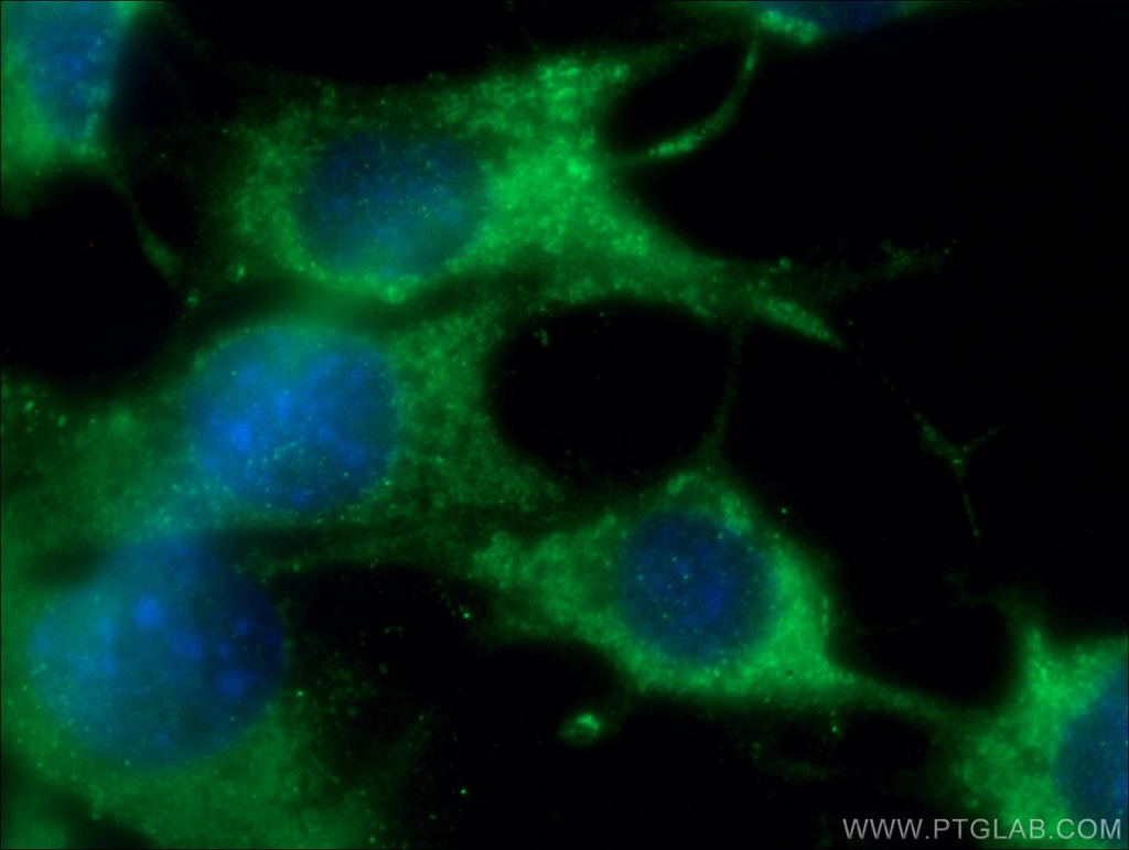 CHMP4B Polyclonal antibody