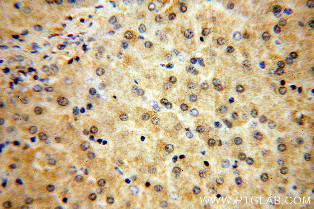 MTMR6 Polyclonal antibody