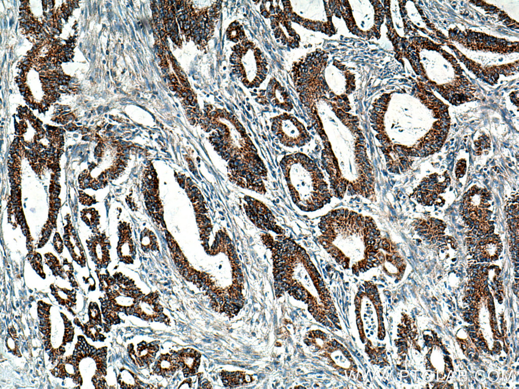 BCKDHB Polyclonal antibody