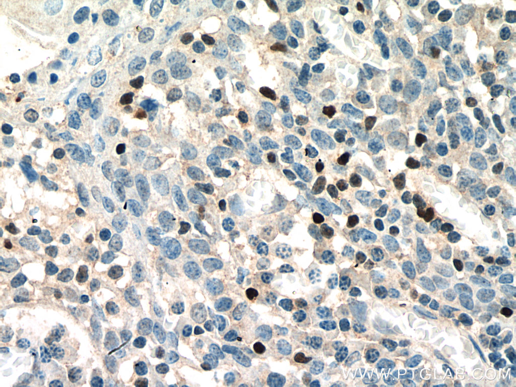 TBX21,T-bet Polyclonal antibody