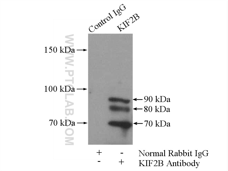 KIF2B Polyclonal antibody