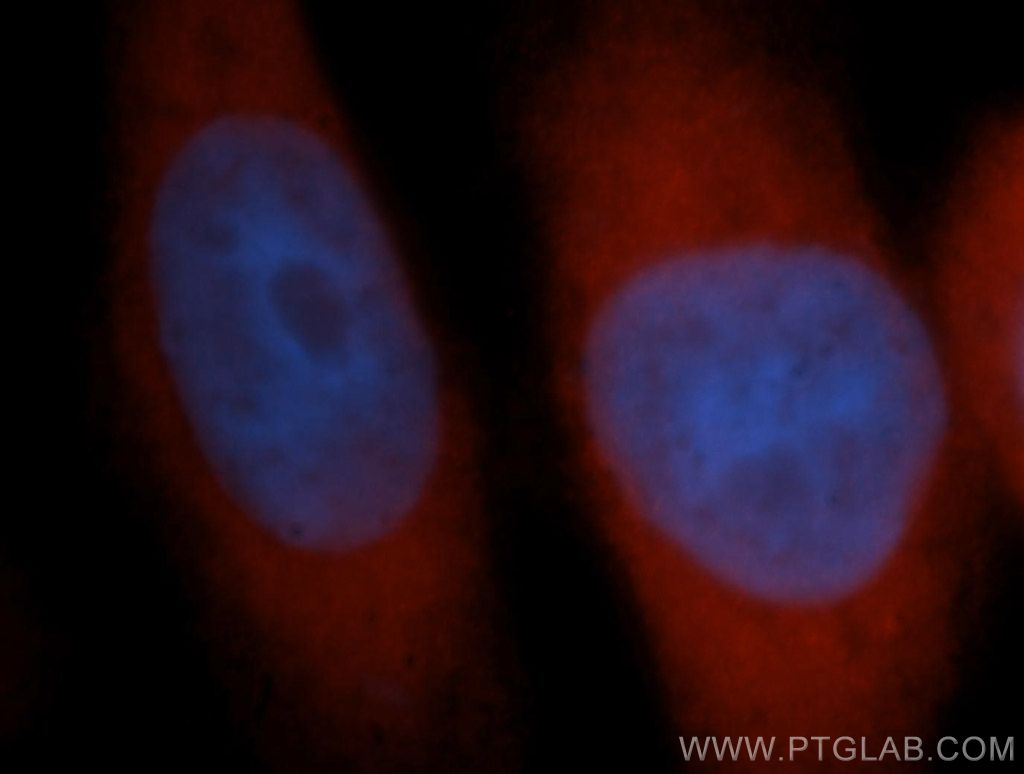 TTF2 Polyclonal antibody