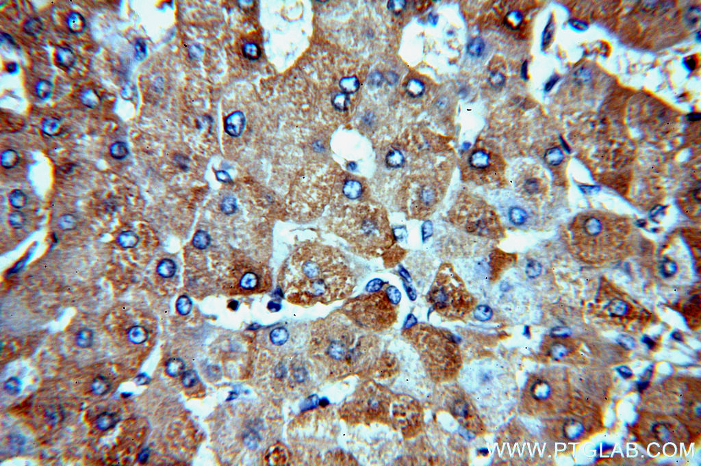 CBR4 Polyclonal antibody