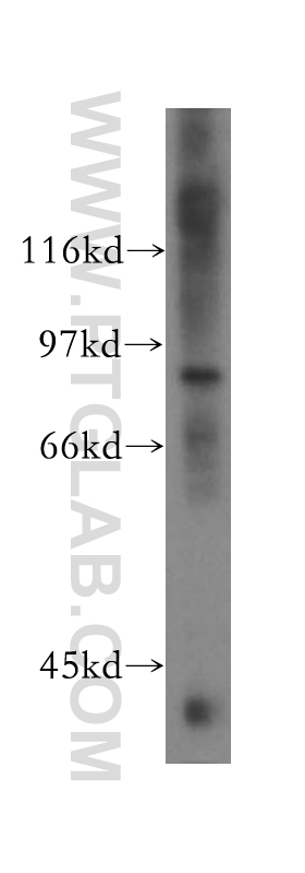 HCN3 Polyclonal antibody