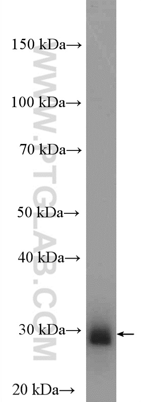 KCNIP4 Polyclonal antibody