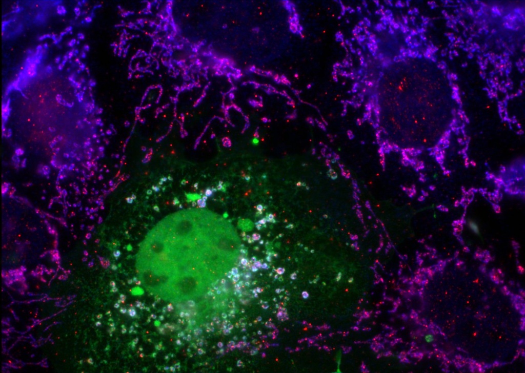 RNase T2 Polyclonal antibody