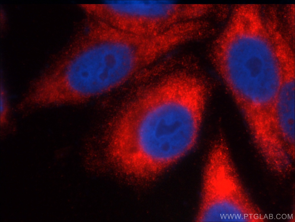 FMR1 Polyclonal antibody