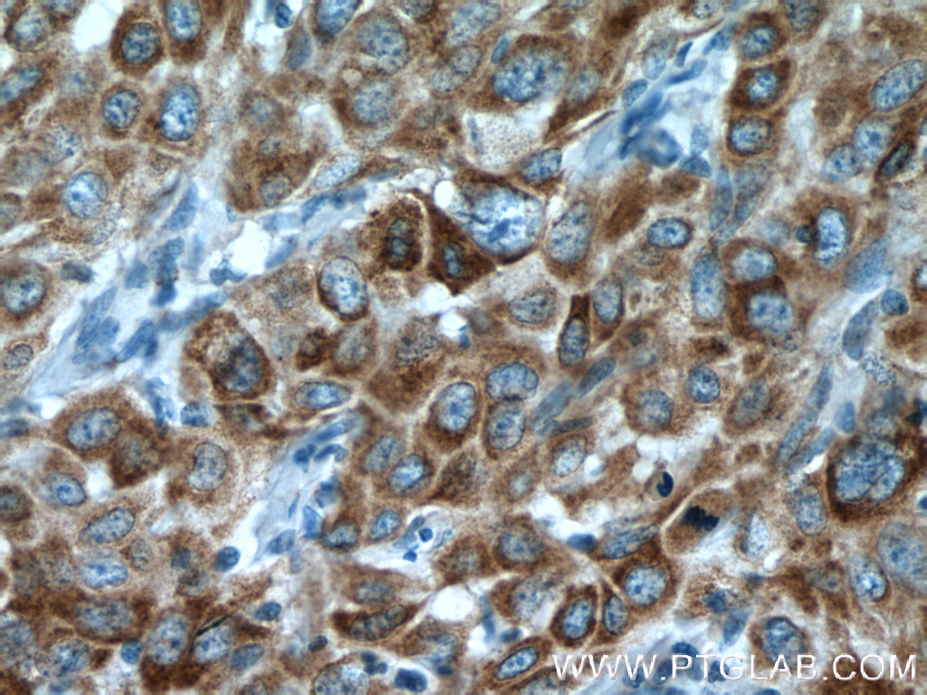 P4HA2 Polyclonal antibody