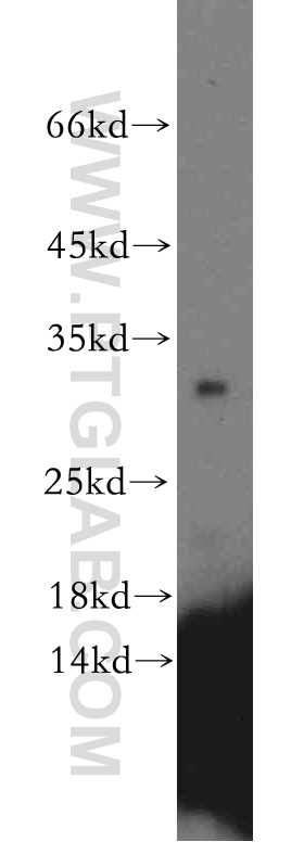 CRYBB1 Polyclonal antibody