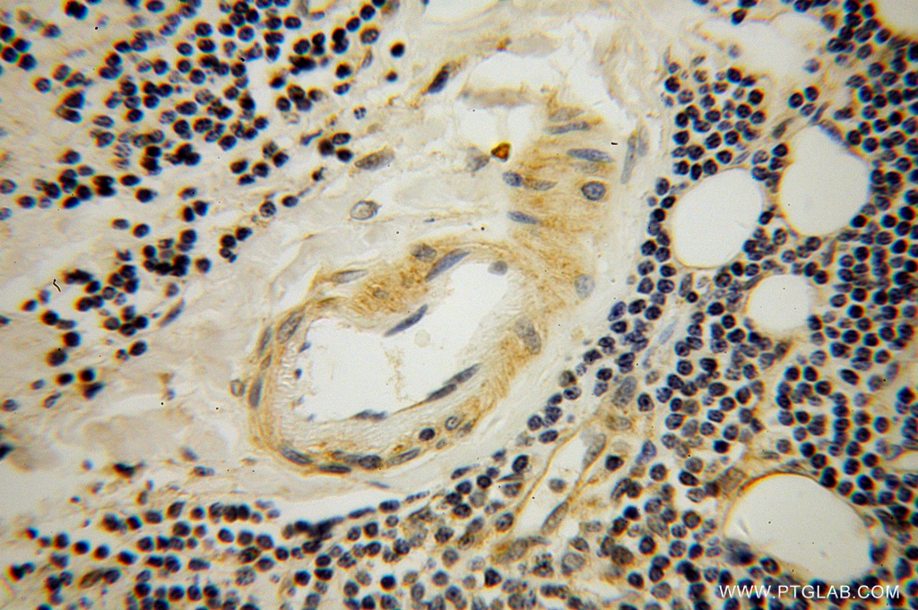 STXBP3 Polyclonal antibody