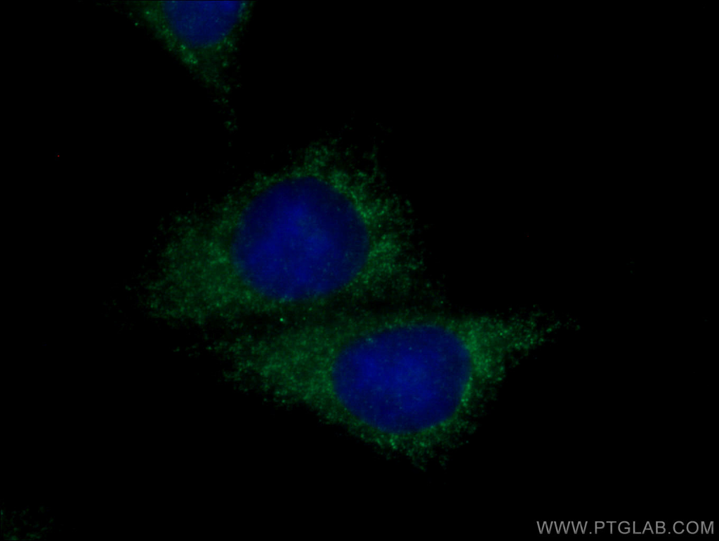Entactin Polyclonal antibody