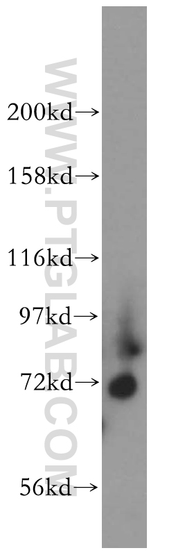 Kv4.1 Polyclonal antibody