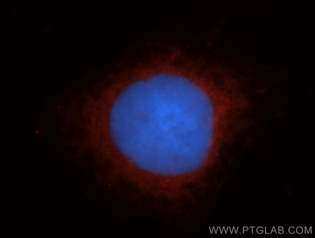 TRAK2 Polyclonal antibody