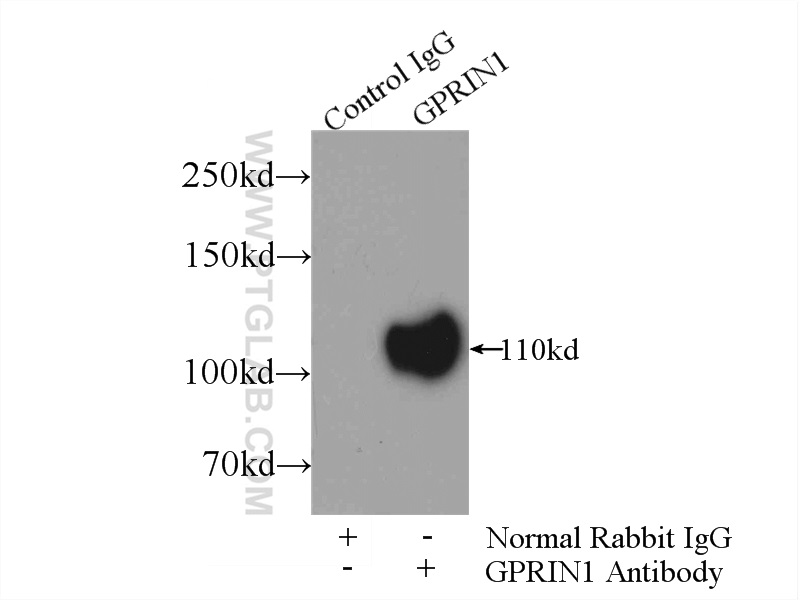GPRIN1 Polyclonal antibody