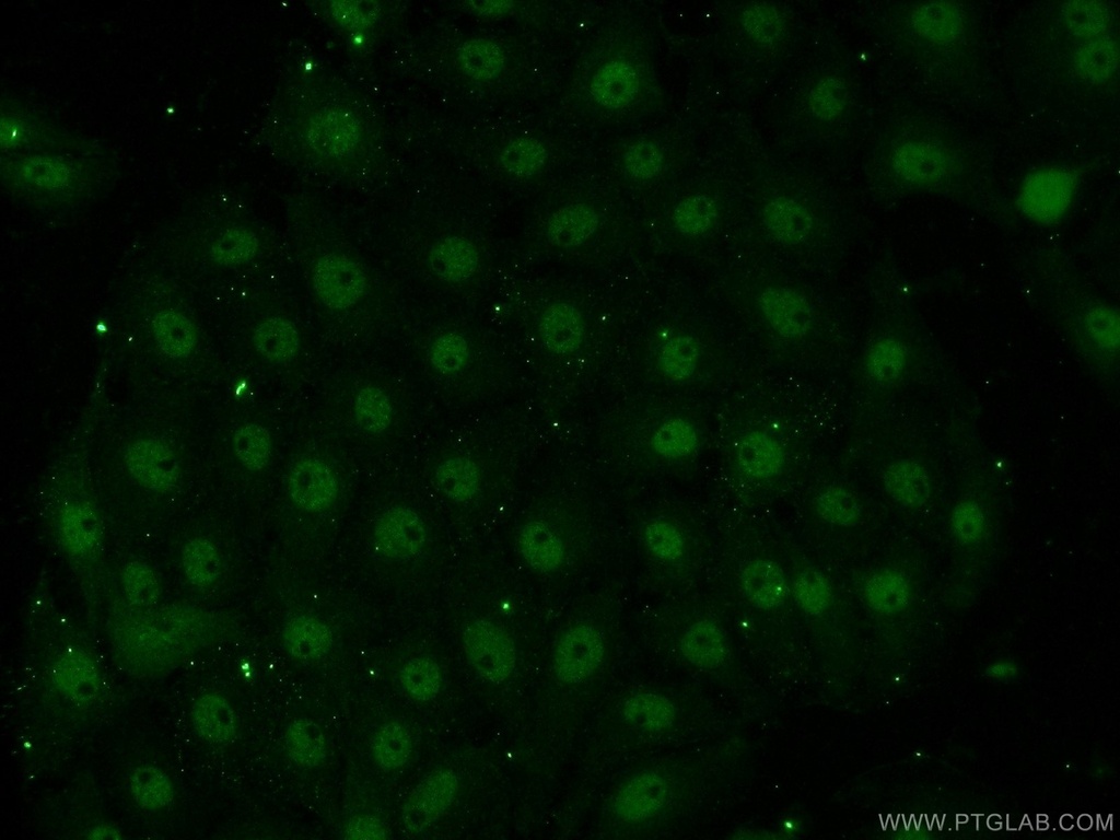 EAF1 Polyclonal antibody