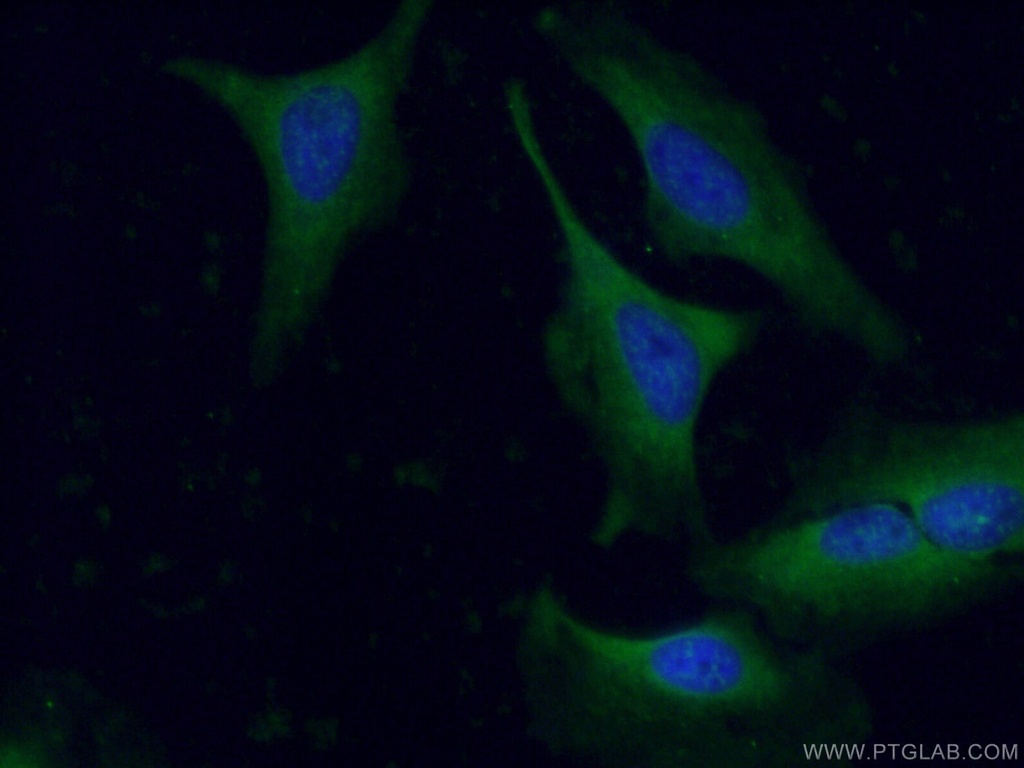 GAS6 Polyclonal antibody