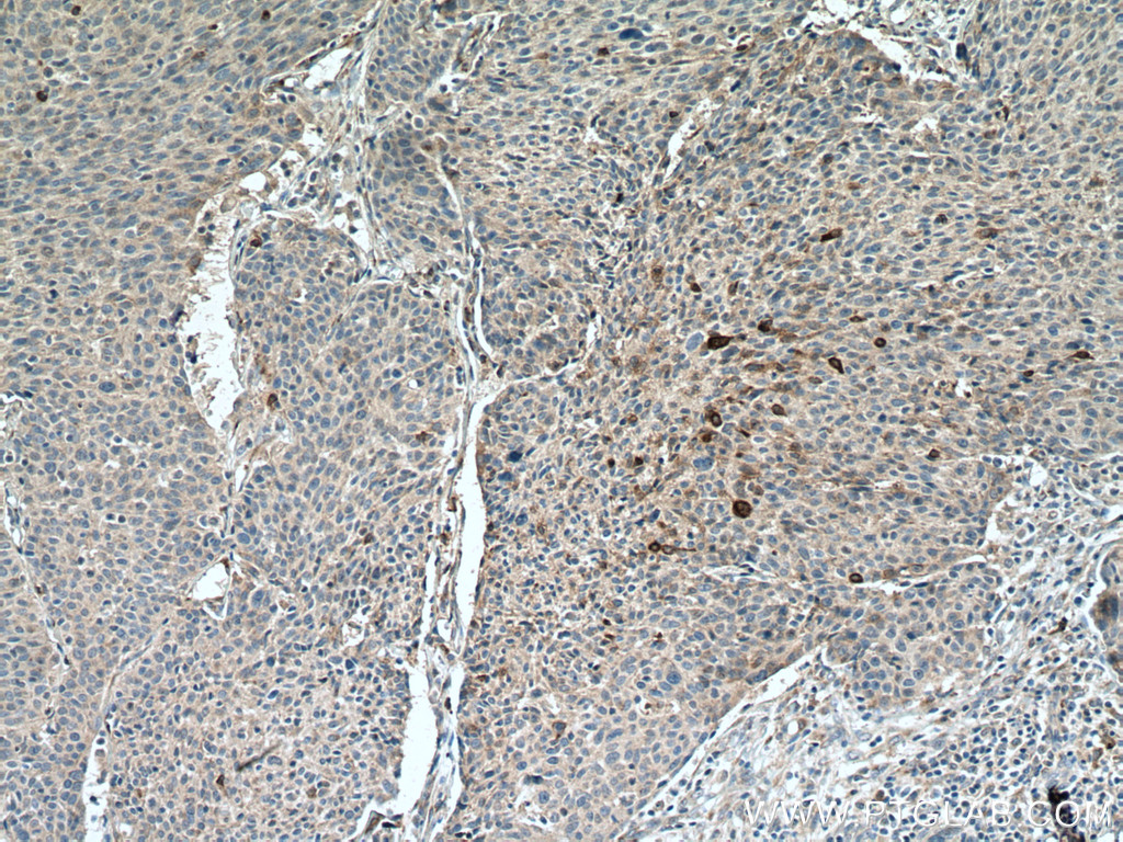 PAI-1 Polyclonal antibody