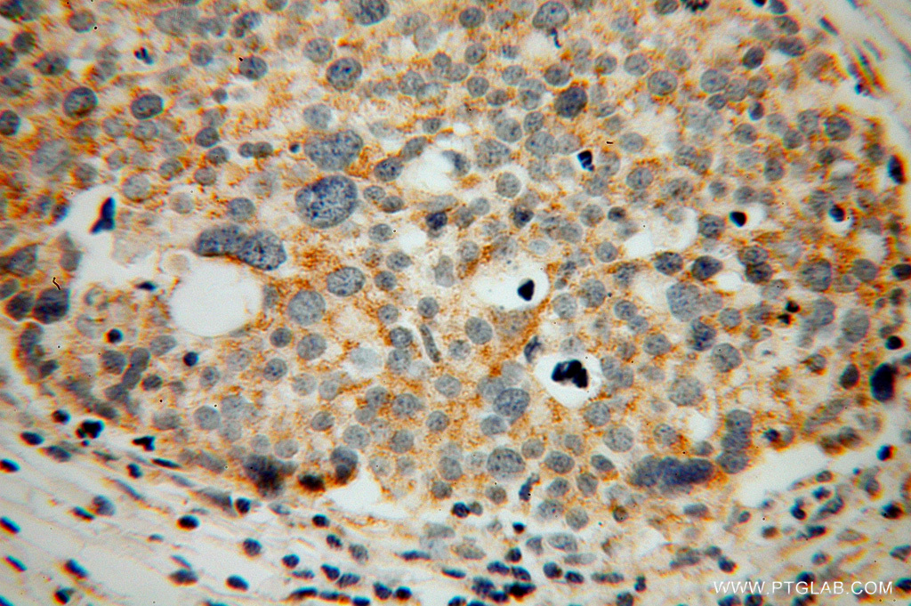 CORO2B Polyclonal antibody