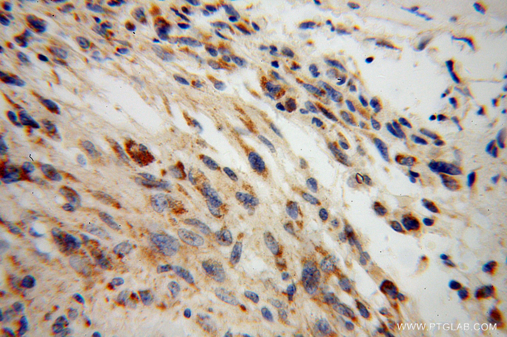 DARS2 Polyclonal antibody