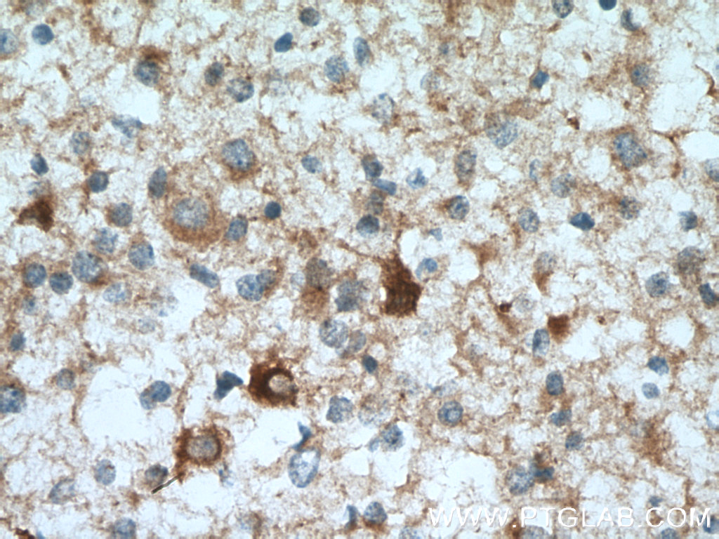 DYNC1I1 Polyclonal antibody
