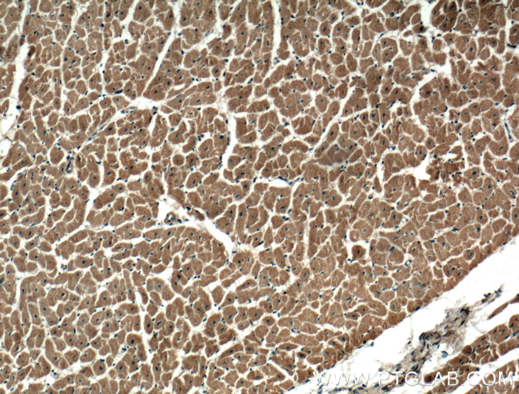 DIXDC1 Polyclonal antibody