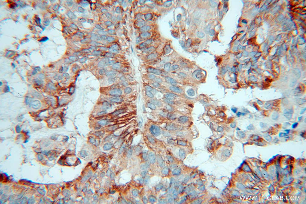 ARTS1 Polyclonal antibody