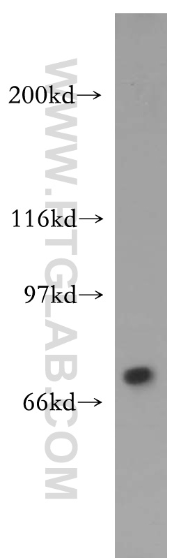 TIGD1 Polyclonal antibody