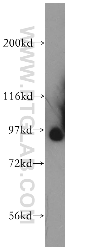 SLITRK4 Polyclonal antibody