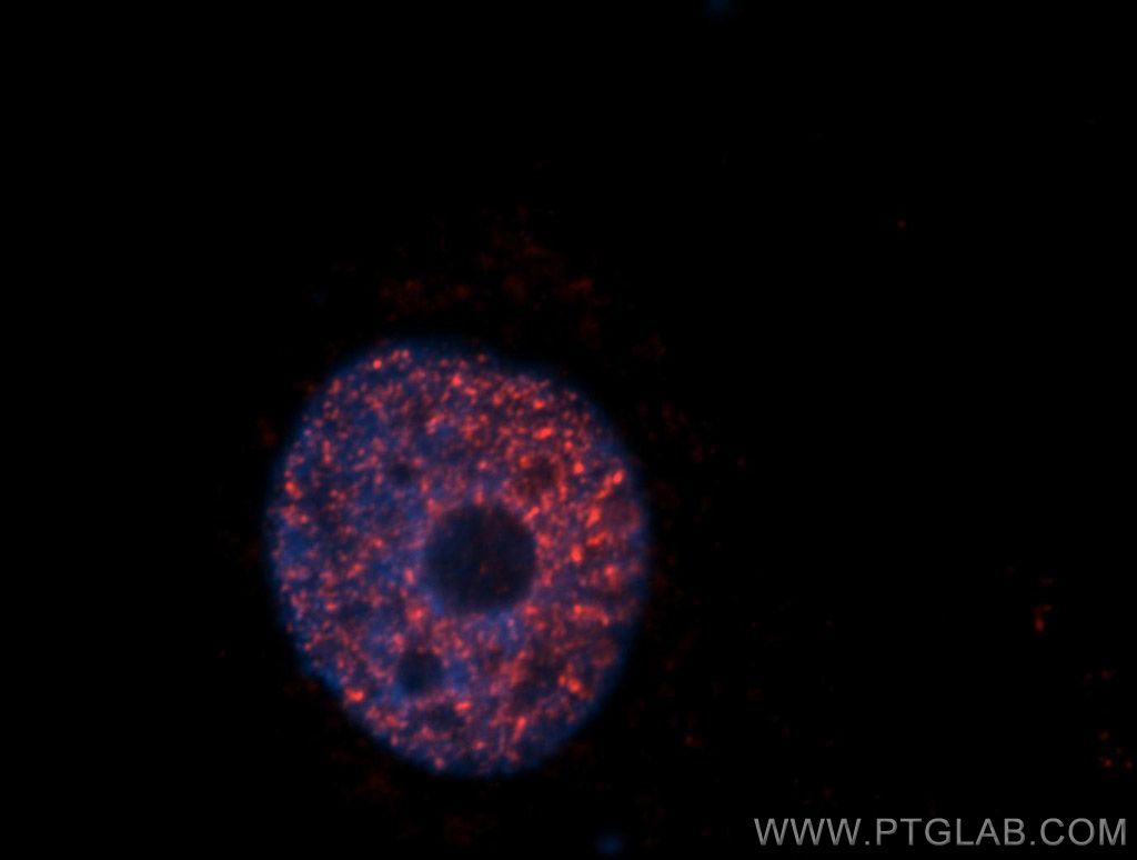 SAP18 Polyclonal antibody