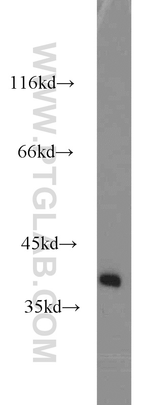 SH3GL3 Polyclonal antibody