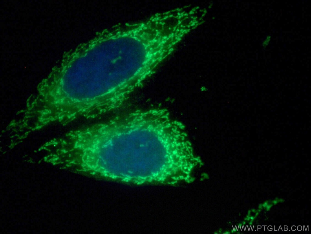 TIMM44 Polyclonal antibody