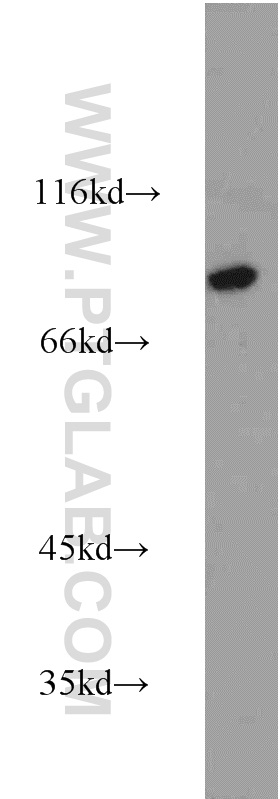 Calpain 7 Polyclonal antibody