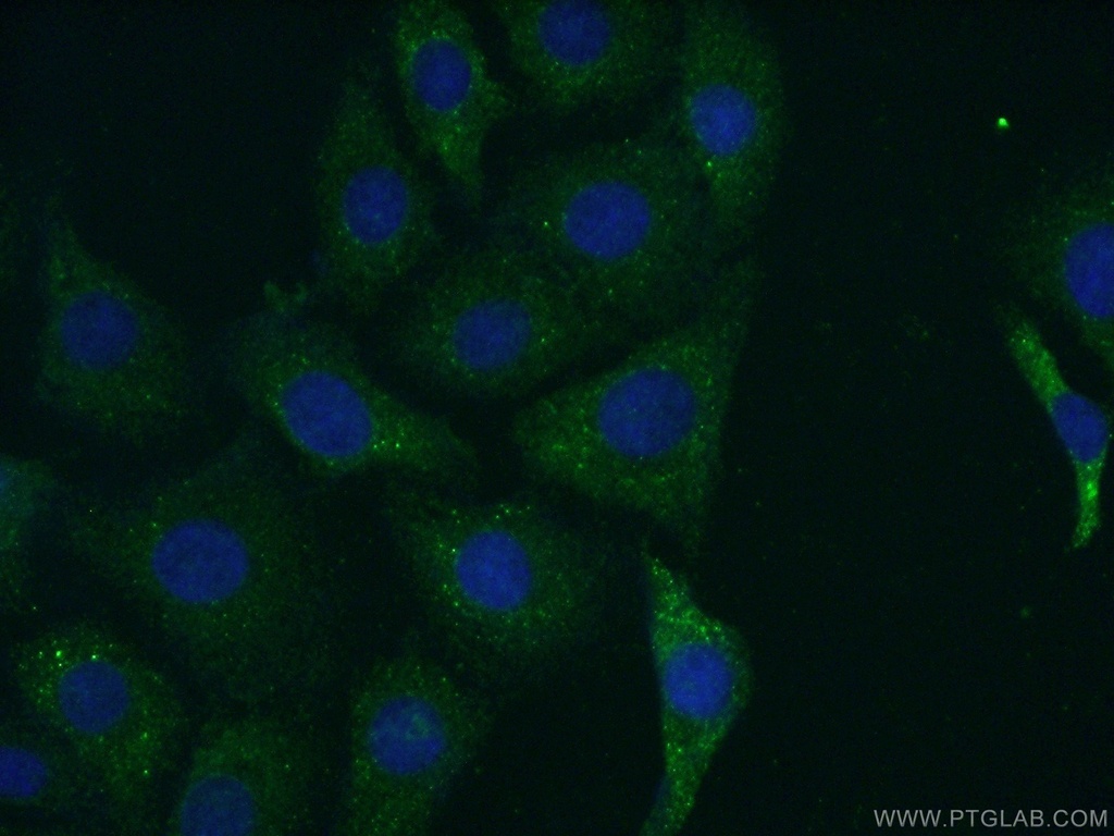 DGKH Polyclonal antibody