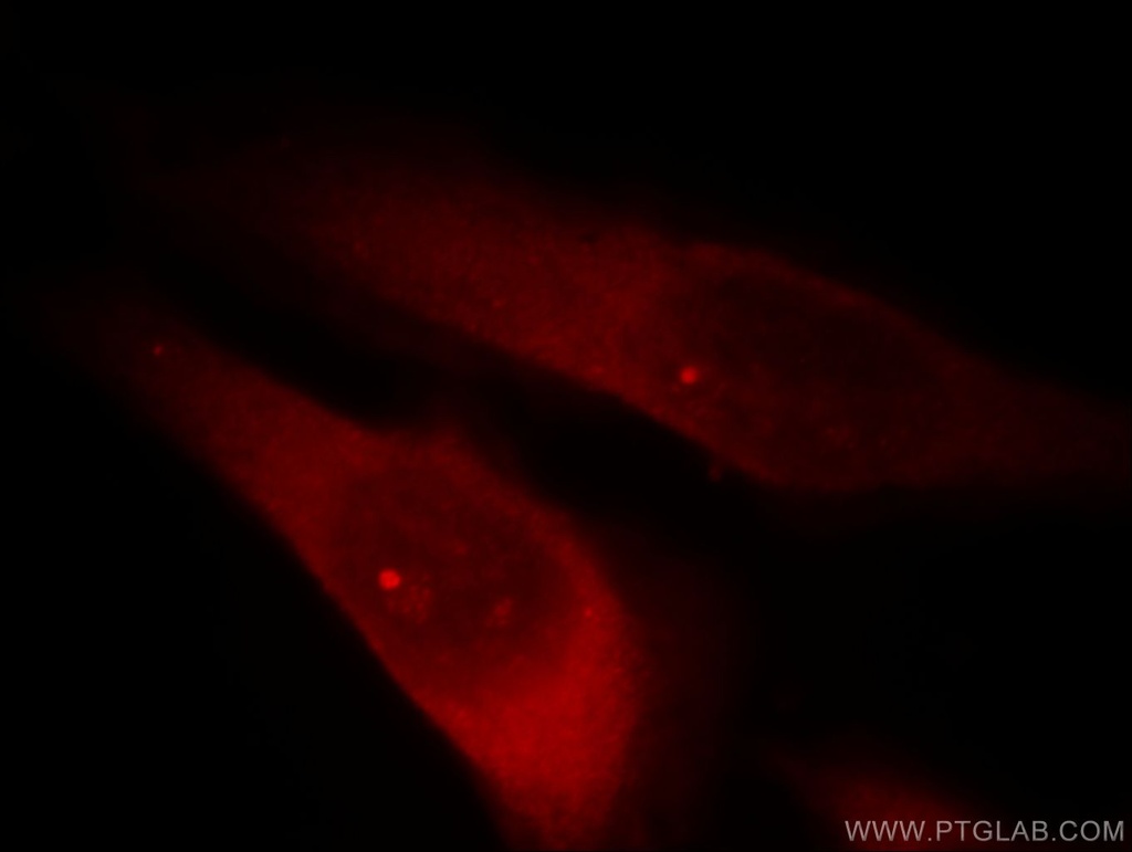 RABGAP1L Polyclonal antibody