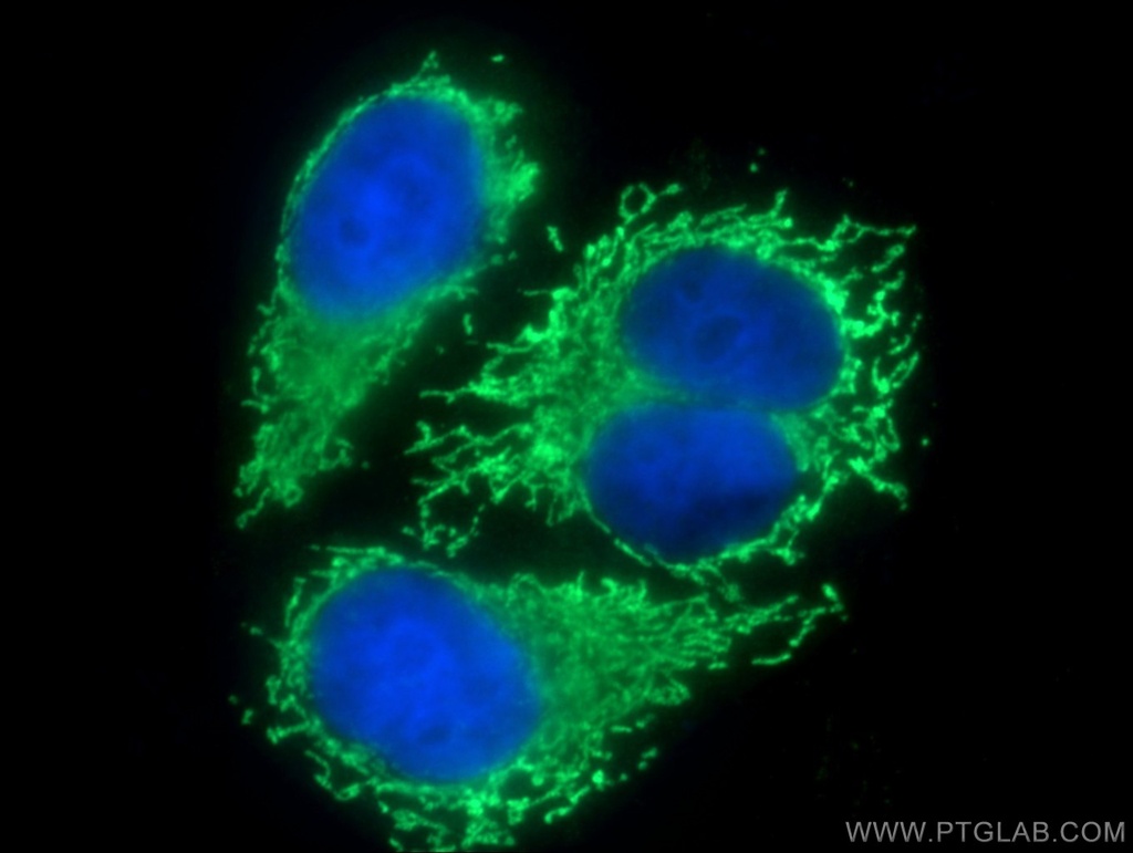 D2HGDH Polyclonal antibody