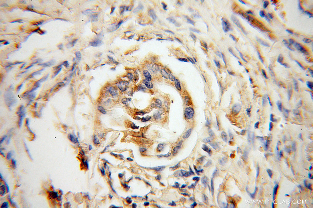 DHDH Polyclonal antibody