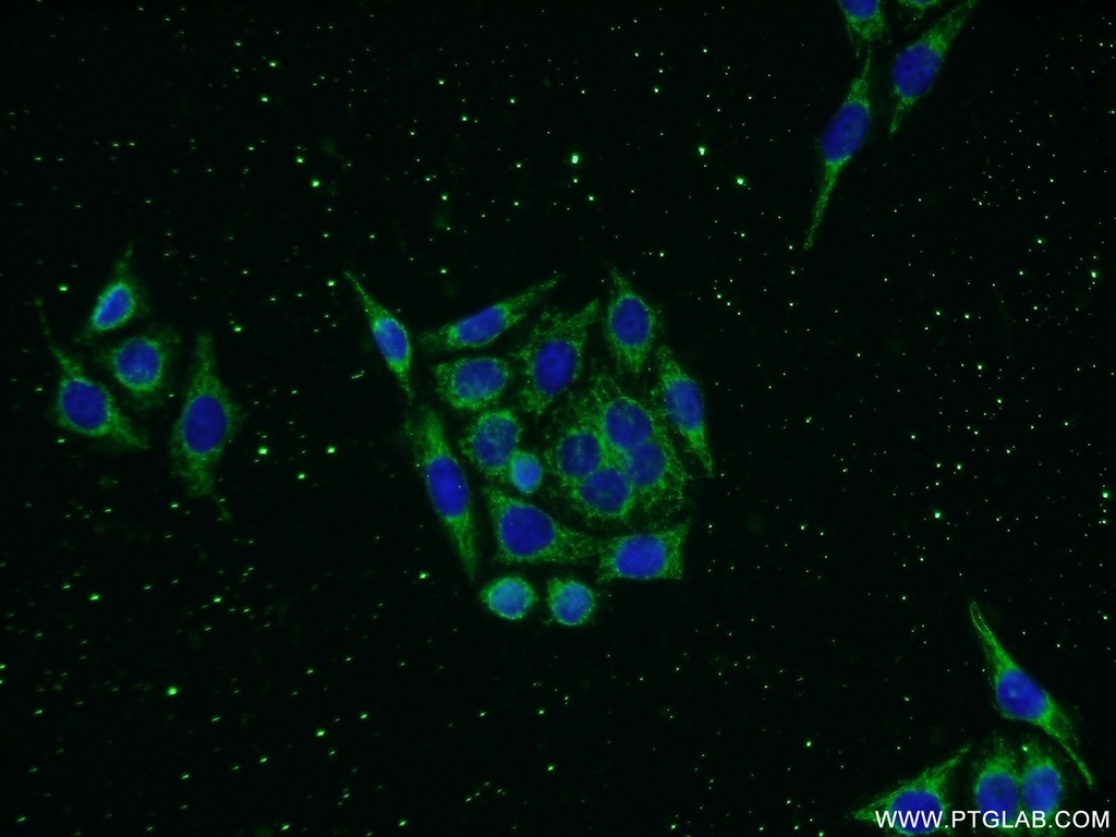 KLHDC3 Polyclonal antibody