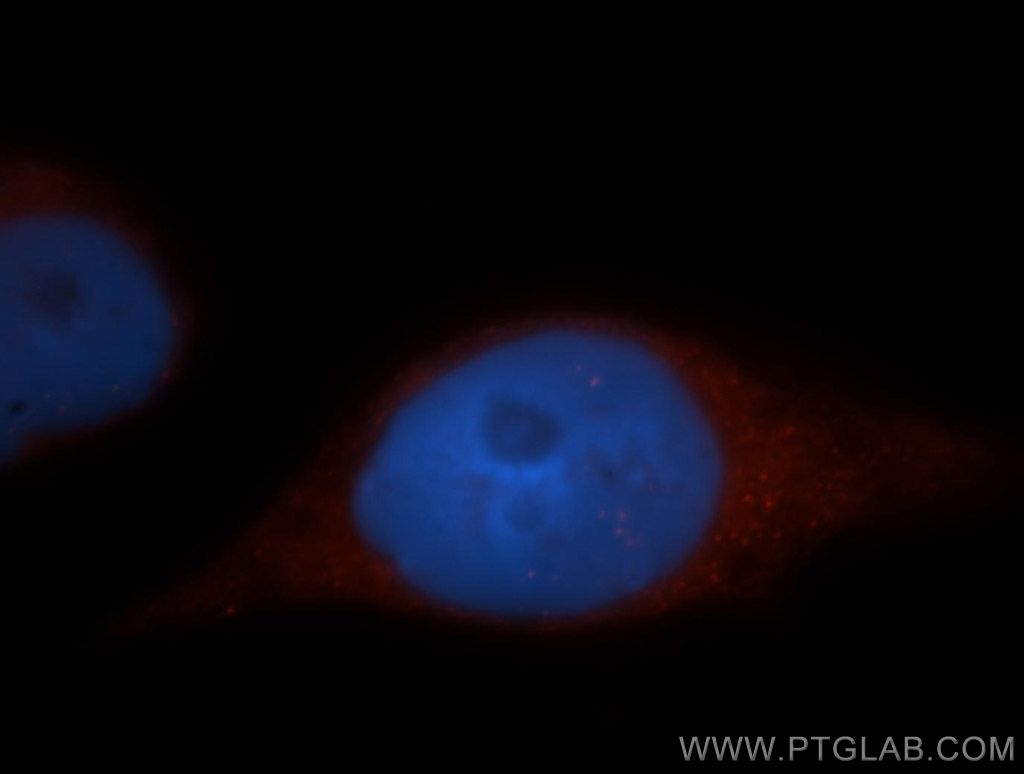 ADAP1 Polyclonal antibody