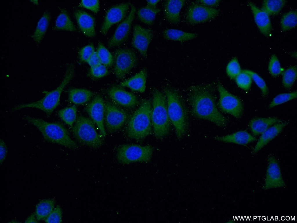 VILIP-1 Polyclonal antibody