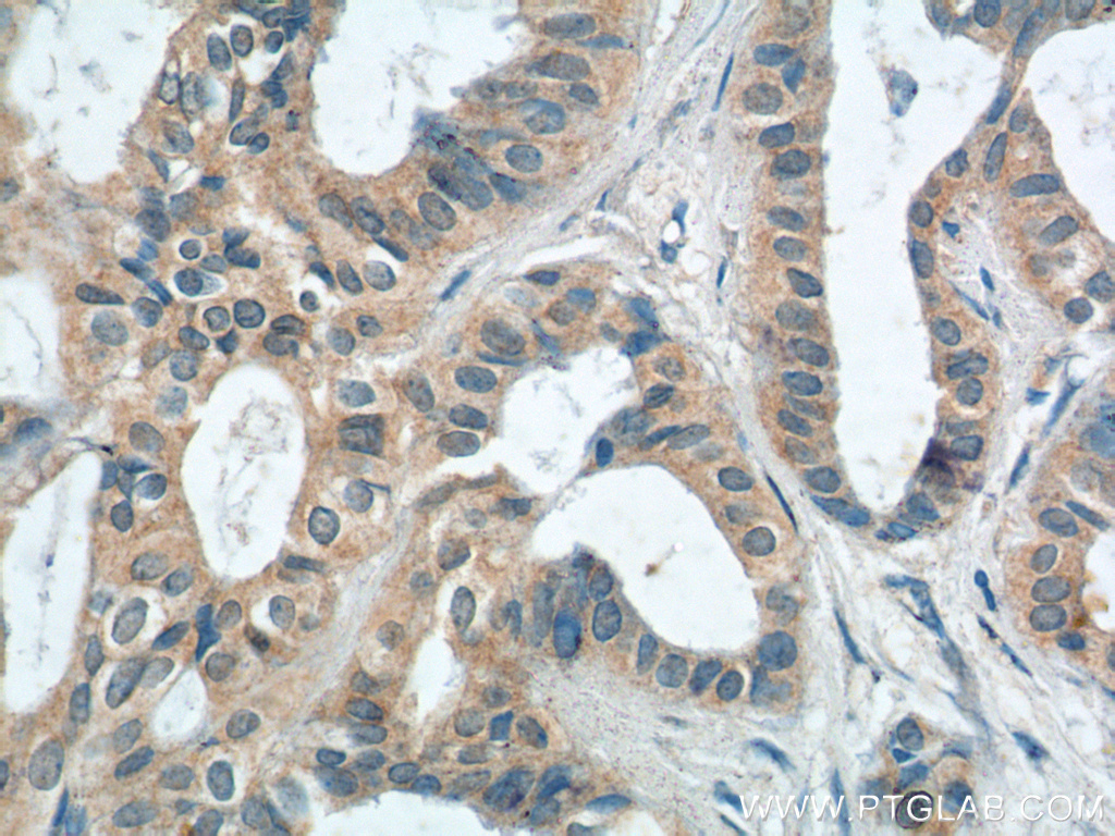 PTPRE Polyclonal antibody