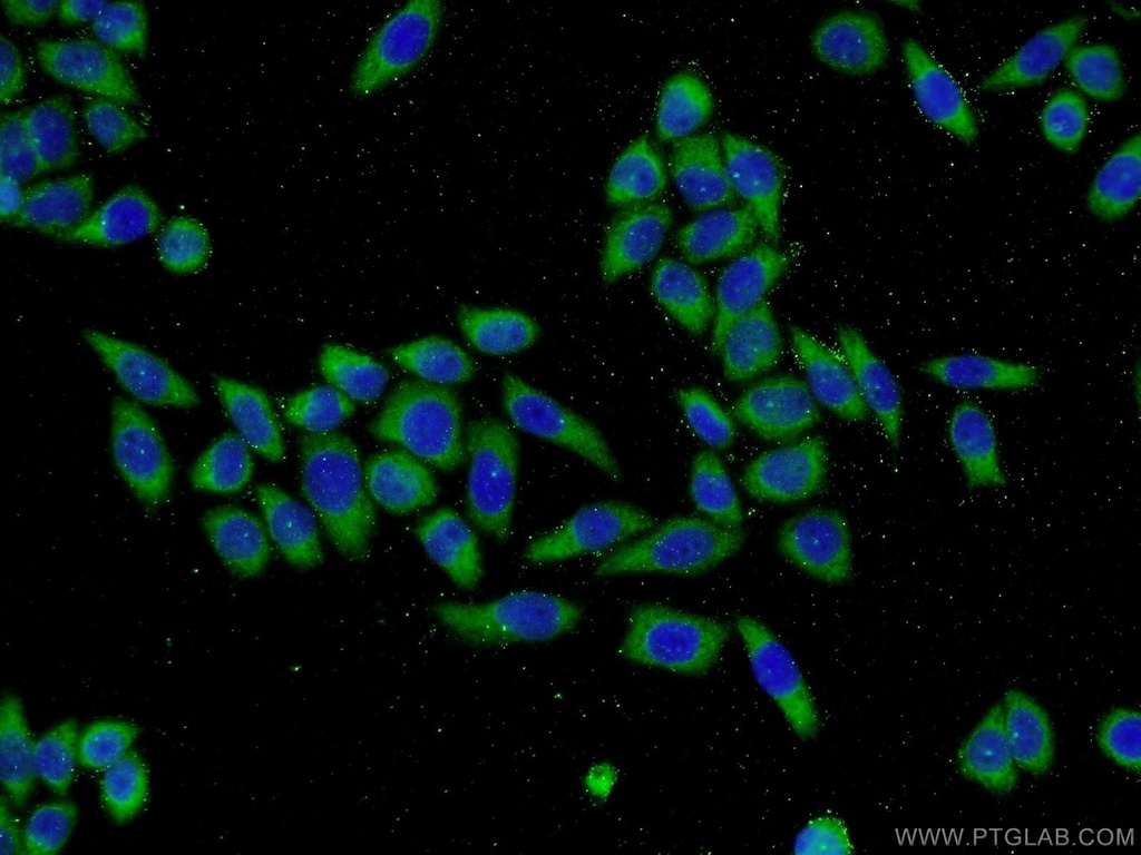 MTM1 Polyclonal antibody