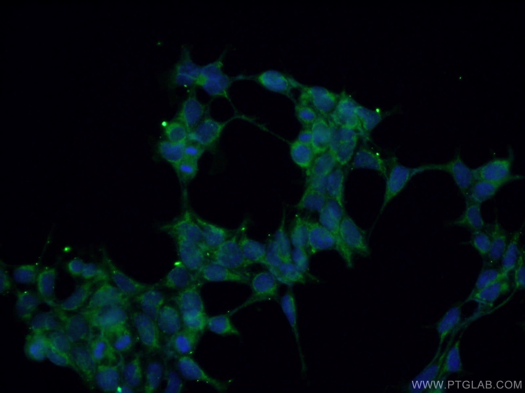 GNAQ Polyclonal antibody