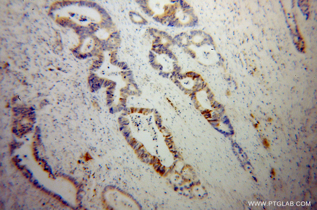 SCNN1G Polyclonal antibody