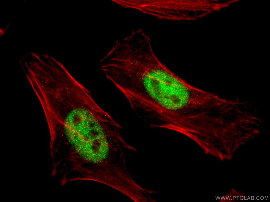 MAPKAPK2 Polyclonal antibody