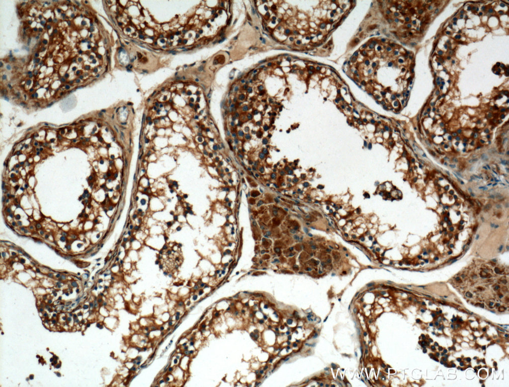 ALDH1A2 Polyclonal antibody